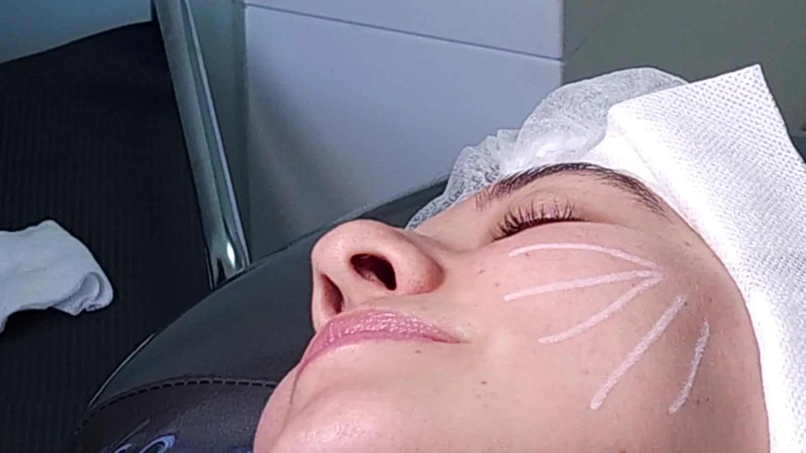 K-Beauty vs. Medical Aesthetics in Korea: What's the Difference?